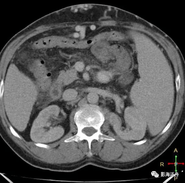 新澳门天天资料,可靠操作策略方案_CT51.749